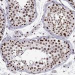 POLDIP3 Antibody in Immunohistochemistry (Paraffin) (IHC (P))