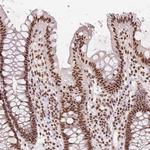 RED Antibody in Immunohistochemistry (Paraffin) (IHC (P))