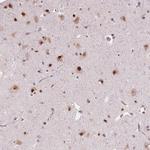 DDX41 Antibody in Immunohistochemistry (Paraffin) (IHC (P))