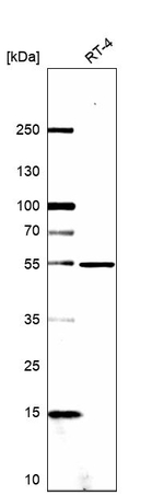 MDMX Antibody in Western Blot (WB)