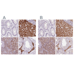 EPHX1 Polyclonal Antibody