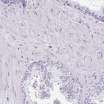 CaV1.1 Polyclonal Antibody