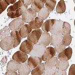 CaV1.1 Antibody in Immunohistochemistry (Paraffin) (IHC (P))
