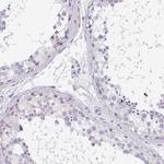 CaV1.1 Antibody in Immunohistochemistry (Paraffin) (IHC (P))