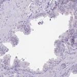 LDB3 Polyclonal Antibody