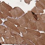 LDB3 Antibody in Immunohistochemistry (Paraffin) (IHC (P))