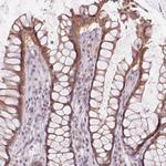 CD298 Antibody in Immunohistochemistry (Paraffin) (IHC (P))