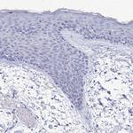 PDE4C Polyclonal Antibody