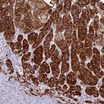 CYP21A2 Antibody in Immunohistochemistry (Paraffin) (IHC (P))