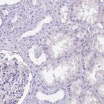 CYP21A2 Antibody in Immunohistochemistry (Paraffin) (IHC (P))