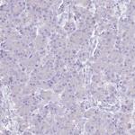 CYP21A2 Antibody in Immunohistochemistry (Paraffin) (IHC (P))