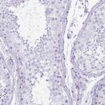 CYP21A2 Antibody in Immunohistochemistry (Paraffin) (IHC (P))