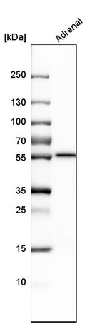 CYP21A2 Antibody in Western Blot (WB)