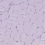 CD68 Antibody in Immunohistochemistry (Paraffin) (IHC (P))