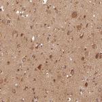 eIF3b Antibody in Immunohistochemistry (Paraffin) (IHC (P))