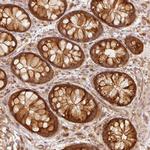 eIF3b Antibody in Immunohistochemistry (Paraffin) (IHC (P))