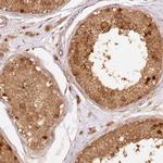 eIF3b Antibody in Immunohistochemistry (Paraffin) (IHC (P))