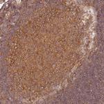 eIF3b Antibody in Immunohistochemistry (Paraffin) (IHC (P))