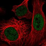 p400 Polyclonal Antibody