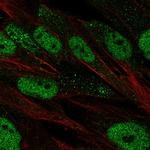 Oct-2 Antibody in Immunocytochemistry (ICC/IF)