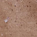 CRMP3 Antibody in Immunohistochemistry (Paraffin) (IHC (P))
