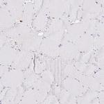 PYCARD Antibody in Immunohistochemistry (Paraffin) (IHC (P))