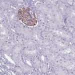 ROS1 Polyclonal Antibody