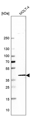 POLB Antibody in Western Blot (WB)