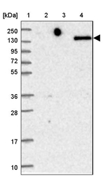 CD205 Antibody in Western Blot (WB)