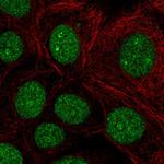 BCL11B Polyclonal Antibody