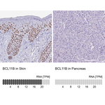 BCL11B Antibody in Immunohistochemistry (Paraffin) (IHC (P))