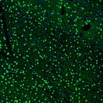BCL11B Antibody in Immunohistochemistry (Paraffin) (IHC (P))