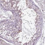 FAM183A Antibody in Immunohistochemistry (Paraffin) (IHC (P))