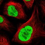 RFC4 Polyclonal Antibody