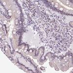 ARHGEF18 Polyclonal Antibody