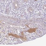 Complement Factor H Antibody in Immunohistochemistry (Paraffin) (IHC (P))