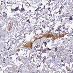 Complement Factor H Antibody in Immunohistochemistry (Paraffin) (IHC (P))