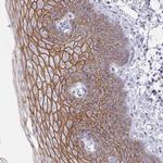 Desmocollin 3 Antibody in Immunohistochemistry (Paraffin) (IHC (P))
