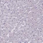 Desmocollin 3 Antibody in Immunohistochemistry (Paraffin) (IHC (P))