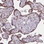 Desmocollin 3 Antibody in Immunohistochemistry (Paraffin) (IHC (P))