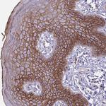 Desmocollin 3 Antibody in Immunohistochemistry (Paraffin) (IHC (P))