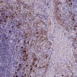 Desmocollin 3 Antibody in Immunohistochemistry (Paraffin) (IHC (P))