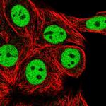 RCOR1 Antibody in Immunocytochemistry (ICC/IF)