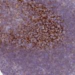 CD35 Antibody in Immunohistochemistry (Paraffin) (IHC (P))