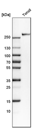 CD35 Antibody in Western Blot (WB)