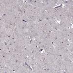 CNGA3 Antibody in Immunohistochemistry (Paraffin) (IHC (P))