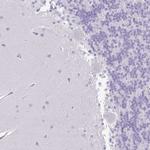 AL592183.1 Antibody in Immunohistochemistry (Paraffin) (IHC (P))