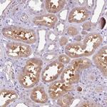 AL592183.1 Antibody in Immunohistochemistry (Paraffin) (IHC (P))