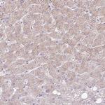 AL592183.1 Antibody in Immunohistochemistry (Paraffin) (IHC (P))