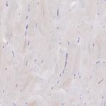 AL592183.1 Polyclonal Antibody